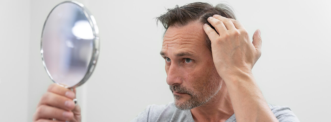 Hair Transplant in Delhi