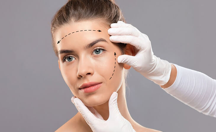 Facelift Surgery