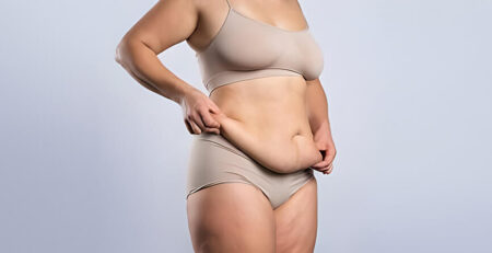 Tummy Tuck Surgery