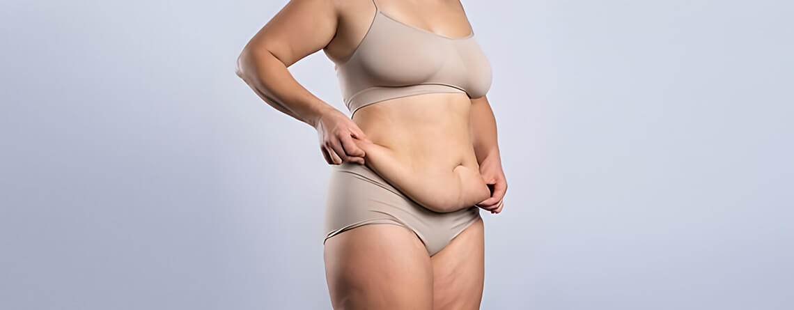 Tummy Tuck Surgery