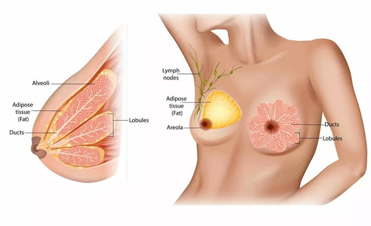 Breast Reduction Surgery