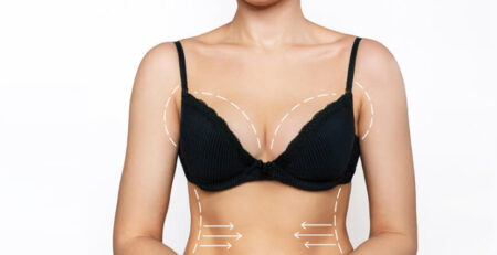 Breast Lift Surgery