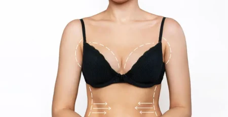 Breast Lift Surgery