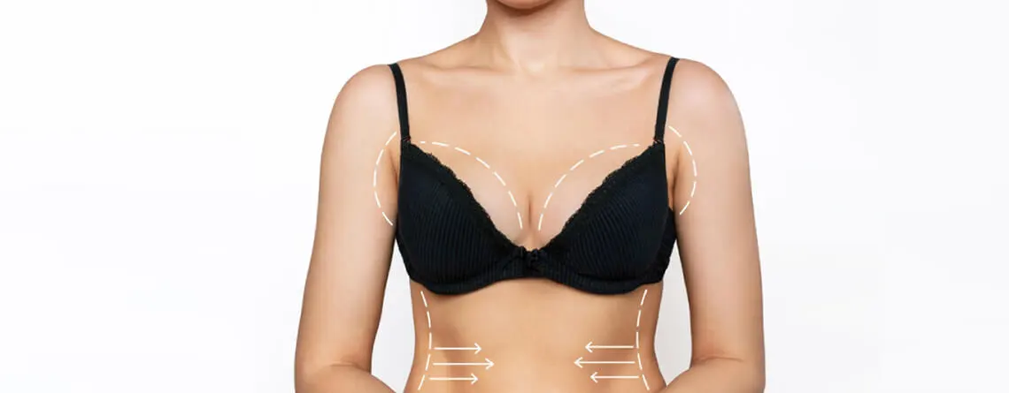 Breast Lift Surgery