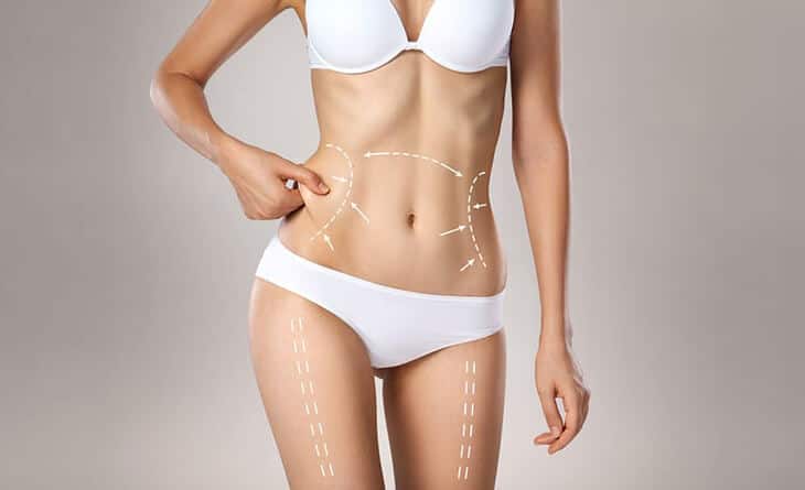 Liposuction Surgery