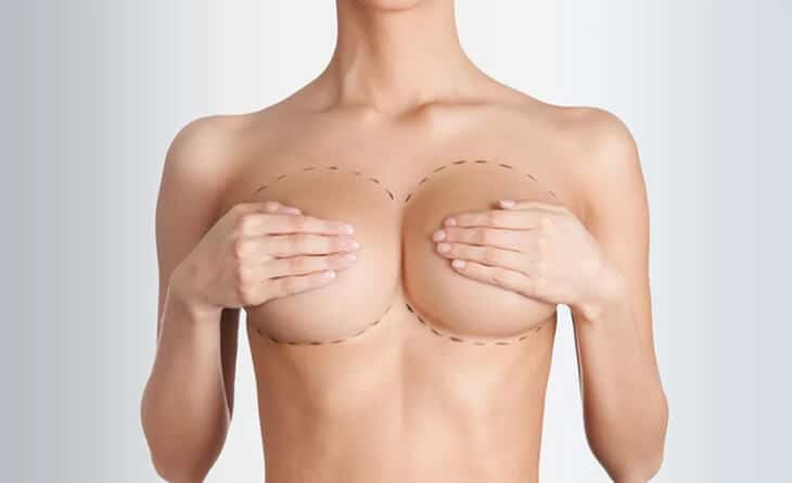 Breast Reduction Surgery