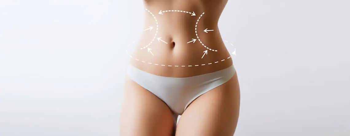 Liposuction surgery