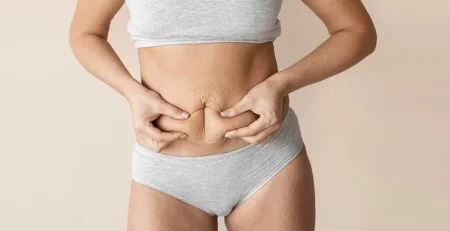 Tummy Tuck Surgery