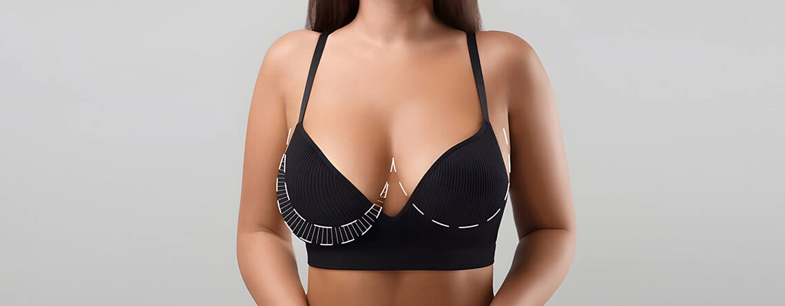 Breast Lift Surgery