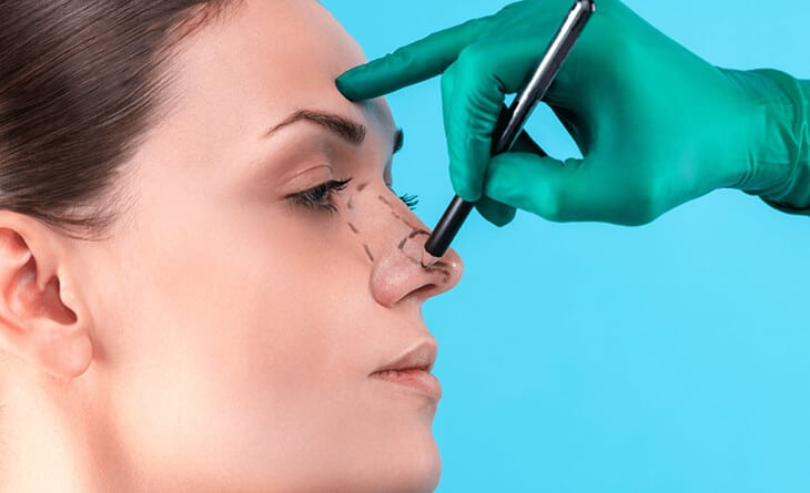 Rhinoplasty Surgery