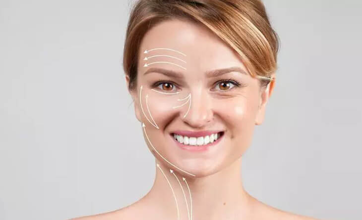 Facelift Surgery