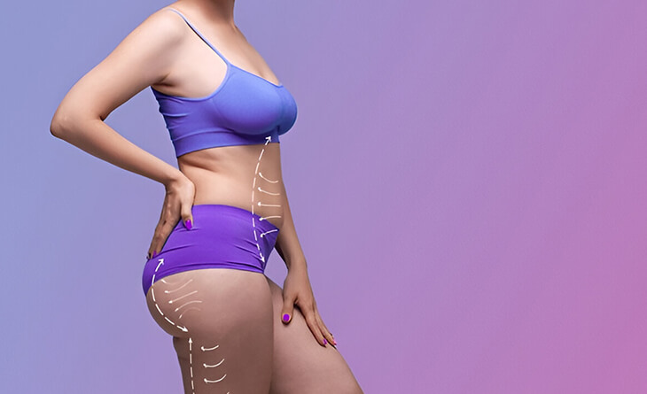 tummy tuck surgery