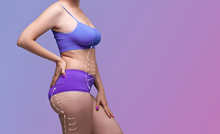 Liposuction Surgery