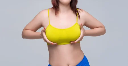 breast reduction surgery