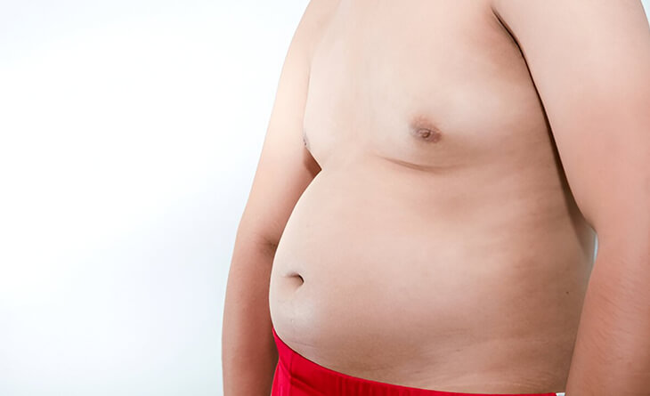 Tummy Tuck for Men