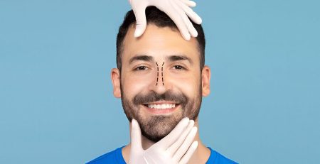 rhinoplasty surgery