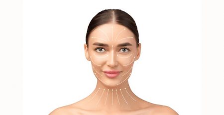 Facelift Surgery