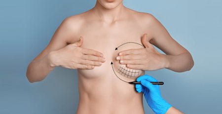 breast lift surgery