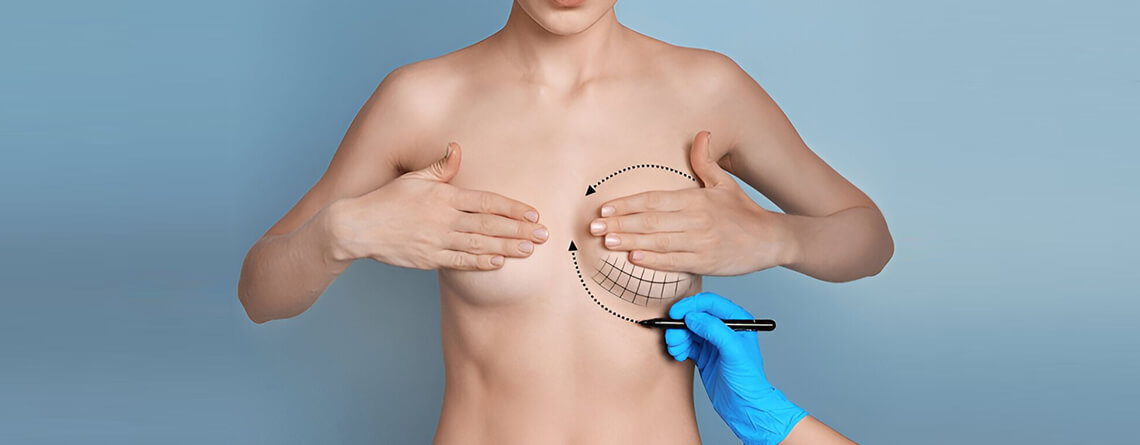 breast lift surgery