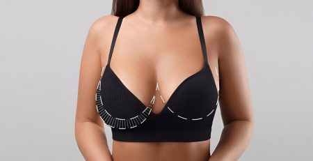 Breast Reduction Surgery