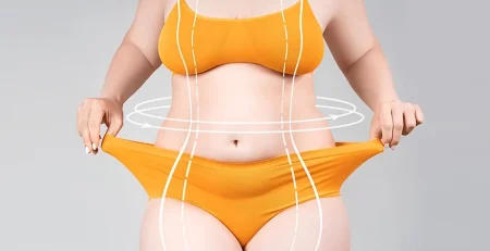 liposuction surgery