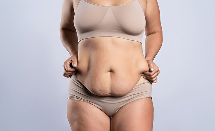 Tummy Tuck Surgery