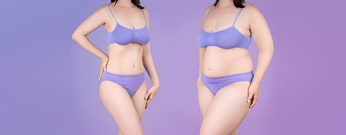 tummy tuck surgery