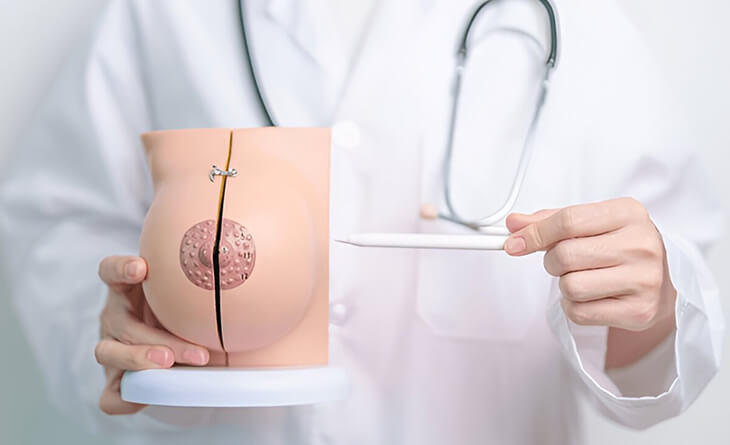 Breast Augmentation Surgery