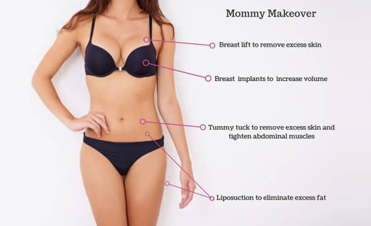 Top 5 Reasons Why Moms Are Opting for a Mommy Makeover - Dr Lokesh Handa - Plastic Surgeon in Delhi -01 liposuction surgery