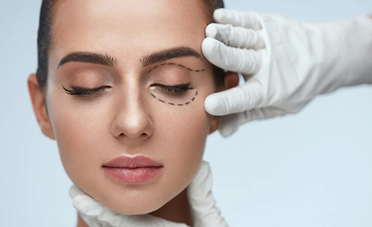 Will Eyelid Surgery Change Your Eye Shape - Dr Lokesh Handa - Plastic Surgeon in Delhi -02 eyelid surgery
