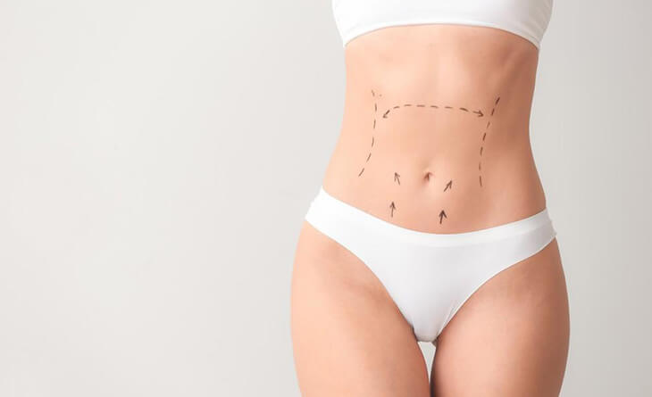 Is Liposuction surgery 100% Safe - Dr Lokesh Handa - Plastic Surgeon in Delhi - Med Esthetiks -02 liposuction surgery