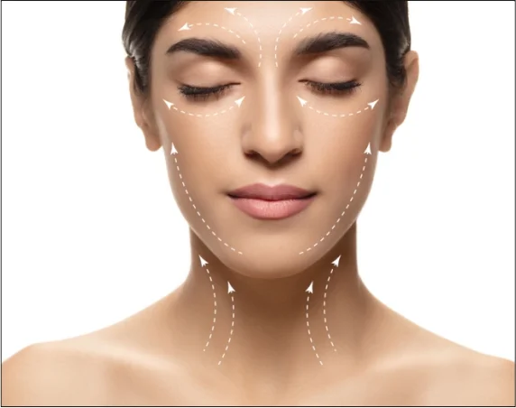 Med Esthetiks_Thread Lift in Delhi_5