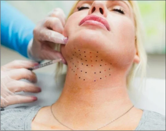 Med Esthetiks_Treatment Options for Double Chin_9